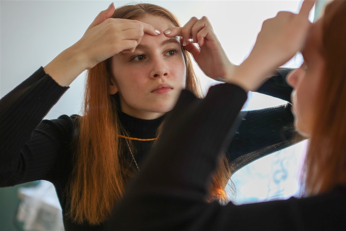 boutons d'acné sur le cuir chevelu